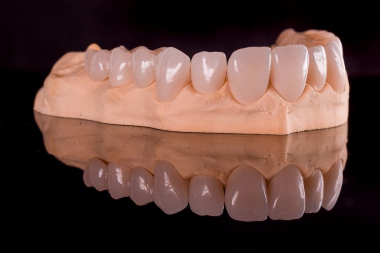 Laborator tehnica dentara Timisoara - Green Dental Lab - Restaurari protetice - coroane zirconiu - tehnicieni dentari