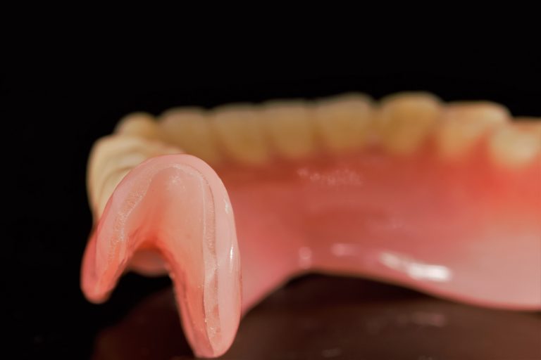 Restaurari protetice mobile - proteze totale - Green Dental Lab - Laborator tehnica dentara
